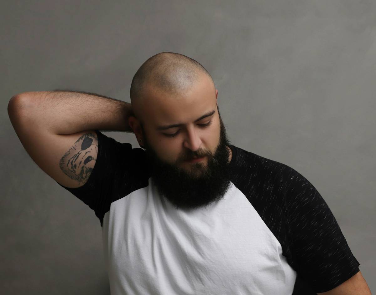 Side-by-side: healthy bald scalp vs. neglected scalp showing flakiness, redness, and ingrown hairs