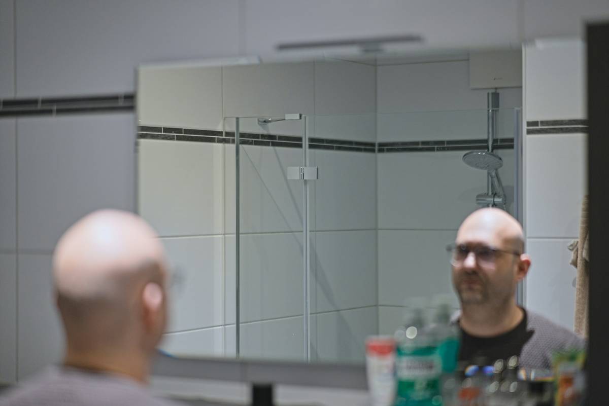 Why Your Bald Head Is Cracking—and the Best Bald Head Moisturizer to Fix It