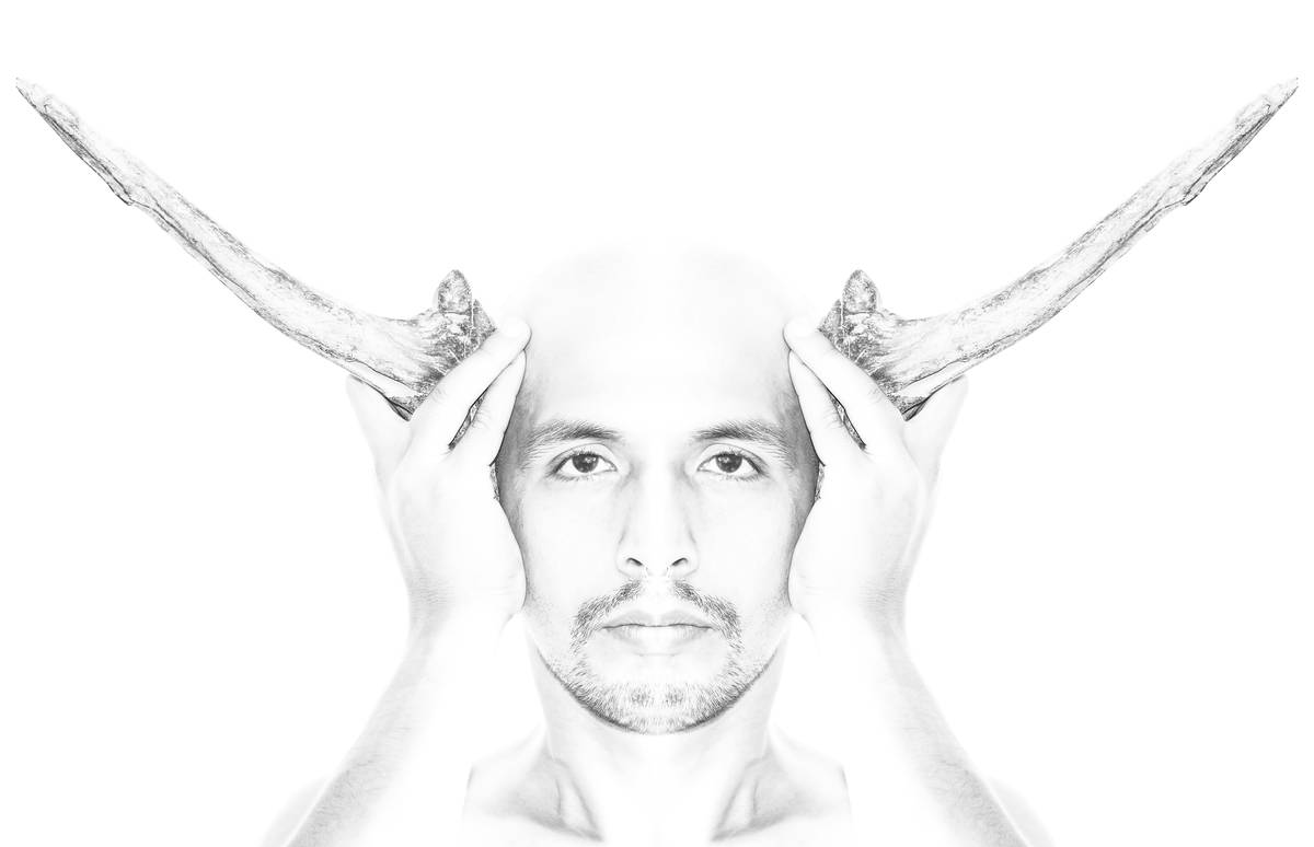 Diagram showing sebaceous gland density comparison between bald scalp and facial skin