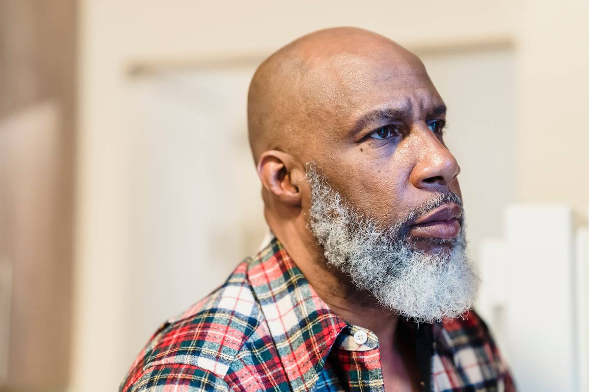 Why Your Bald Head Needs a Bald Head Moisturizer Shea Moisture—And How to Pick the Right One