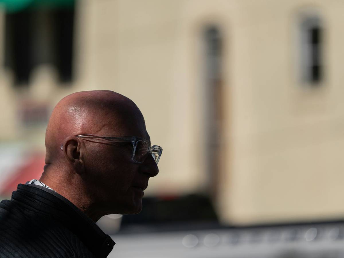 bald man applying sunscreen as part of bald scalp treatment for men