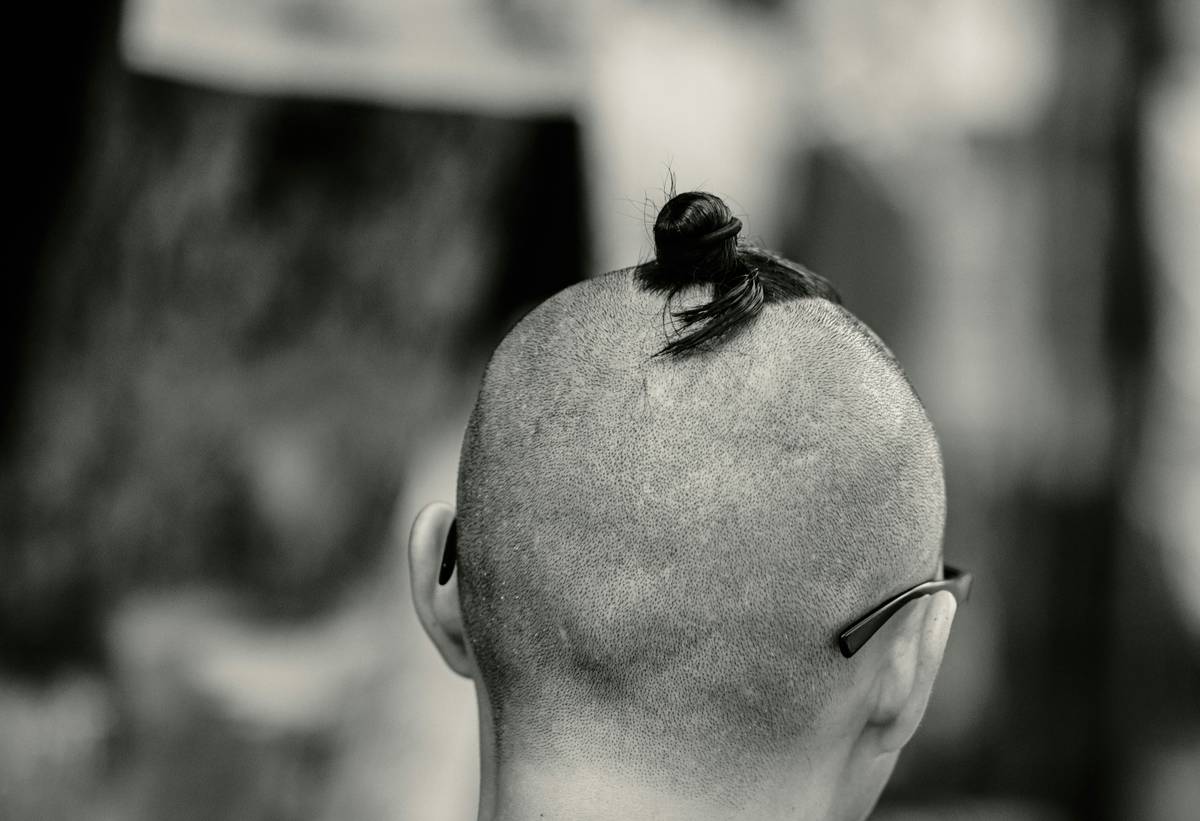 Woman applying post-shave balm to bald head after hair loss shaving head routine