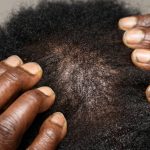 Skin Care for Bald Head: The Moisture & Protection Protocol Most Dermatologists Won’t Tell You